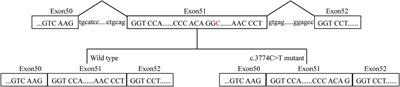 Case report: Autosomal recessive type 3 Stickler syndrome caused by compound heterozygous mutations in COL11A2